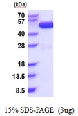 Human CSK protein, His tag. GTX67330-pro