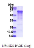 Human Casein Kinase 1 delta protein, His tag. GTX67332-pro