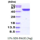 Human Casein Kinase 2 alpha protein, His tag. GTX67333-pro