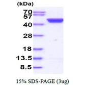Human Casein Kinase 2 alpha protein, His tag. GTX67333-pro