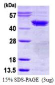 Human Casein Kinase 2 alpha protein, His tag. GTX67334-pro