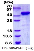 Human CSNK2A2 protein, His tag. GTX67335-pro