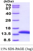 Human Cystatin A protein, His tag. GTX67338-pro