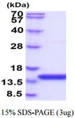 Human Cystatin B protein, His tag. GTX67339-pro