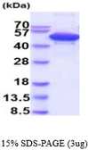 Human cleavage stimulation factor protein, His tag. GTX67341-pro