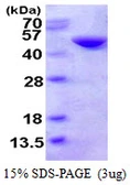 Human CTH protein, His tag. GTX67343-pro