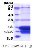 Human DAP1 protein, His tag. GTX67345-pro