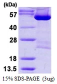 Human DARS protein, His tag. GTX67346-pro