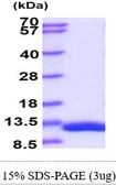 Human DBI protein, His tag. GTX67347-pro