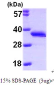 Human DCK protein, His tag. GTX67348-pro