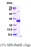 Human DCTD protein, His tag. GTX67349-pro