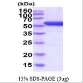 Human DOPA Decarboxylase protein, His tag. GTX67350-pro