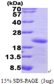 Human GADD45A protein, His tag. GTX67351-pro