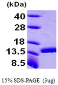 Human DDT protein, His tag. GTX67353-pro