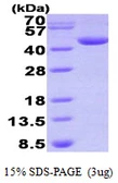 Human DHPS protein, His tag. GTX67356-pro