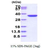 Human NQO1 protein, His tag. GTX67357-pro