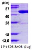 Human DNMT2 protein, His tag. GTX67358-pro