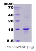 Human Calcipressin 1 protein. GTX67361-pro