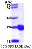 Human DTYMK protein, His tag. GTX67363-pro
