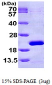 Human EIF1AX protein, His tag. GTX67369-pro