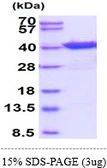 Human eIF2 alpha protein, His tag. GTX67370-pro
