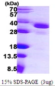 Human EIF2B1 protein, His tag. GTX67371-pro