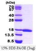 Human EIF5A protein. GTX67375-pro