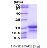 Human ENSA protein, His tag. GTX67377-pro