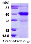Human ERCC1 protein, His tag. GTX67378-pro