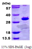 Human ETFB protein, His tag. GTX67381-pro