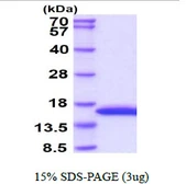 Human L-FABP protein, His tag. GTX67383-pro