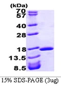 Human FABP2 protein, His tag. GTX67384-pro