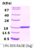 Human FABP3 protein, His tag. GTX67385-pro