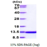 Human ILBP protein. GTX67387-pro