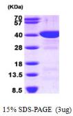 Human FBP1 protein, His tag. GTX67389-pro