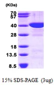 Human FBP1 protein, His tag. GTX67389-pro