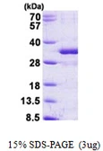 Human FGF14 protein, His tag. GTX67392-pro