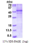 Human FRA2 protein, His tag. GTX67396-pro