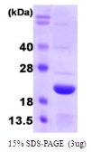 Human Ferritin Light Chain protein. GTX67398-pro