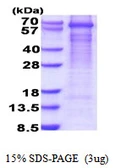 Human GAD67 protein, His tag. GTX67399-pro