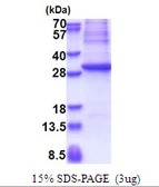 Human GAD67 protein, His tag. GTX67400-pro