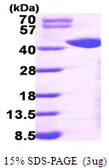 Human GALK1 protein, His tag. GTX67402-pro