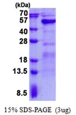 Human GALT protein, His tag. GTX67403-pro
