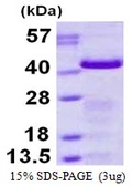 Human GAP43 protein, His tag. GTX67405-pro