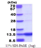 Human GCHFR protein, His tag. GTX67407-pro