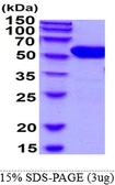 Human Glucokinase protein, His tag. GTX67408-pro