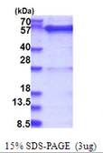 Human GDI1 protein, His tag. GTX67409-pro