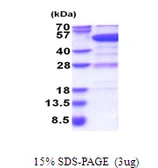 Human GDI2 protein, His tag. GTX67410-pro