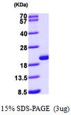 Human GMF beta protein, His tag. GTX67417-pro