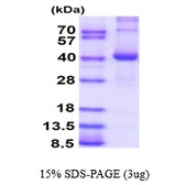 Human GMPR1 protein, His tag. GTX67418-pro